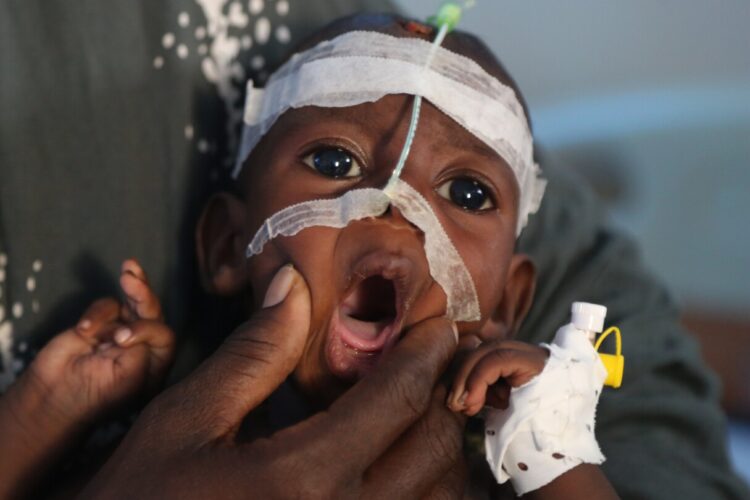 Somalia’s crumbling hospitals show the toll of aid cuts and war